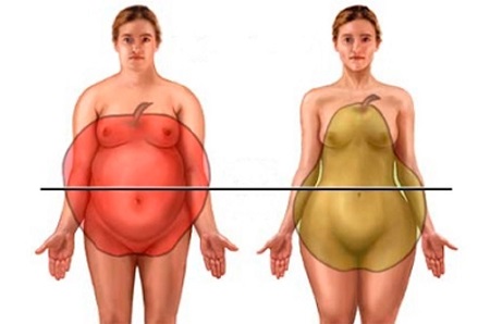 ожирение у женщин